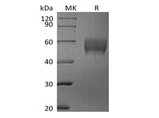 SIGLEC7 / CD328 Protein - Recombinant Human Siglec-7/CD328 (C-6His)