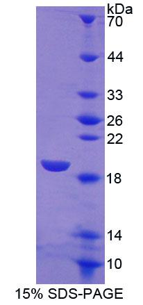 SIGLEC7 / CD328 Protein - Recombinant Sialic Acid Binding Ig Like Lectin 7 By SDS-PAGE