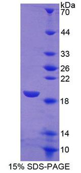 SIGLEC7 / CD328 Protein - Recombinant Sialic Acid Binding Ig Like Lectin 7 By SDS-PAGE