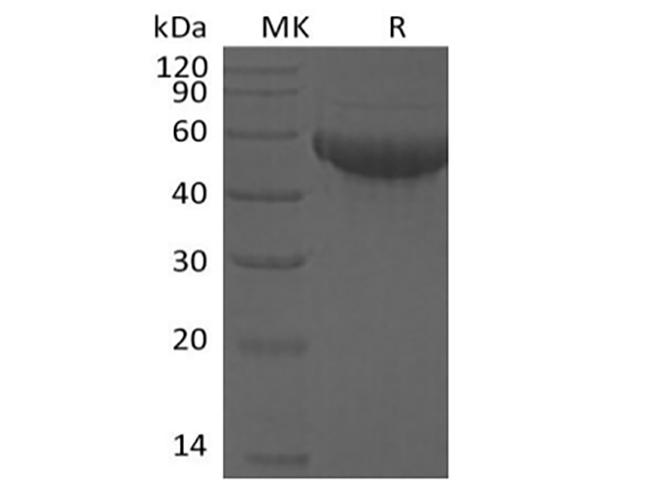 SIGLEC8 Protein - Recombinant Human Siglec-8 (C-6His)