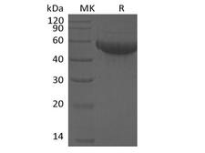 SIGLEC8 Protein - Recombinant Human Siglec-8 (C-6His)
