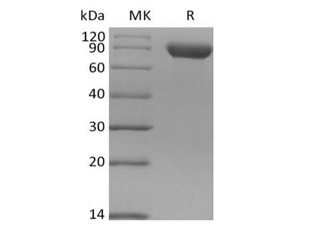 SIGLEC8 Protein - Recombinant Human Siglec-8 (C-Fc)