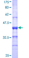SIGLEC8 Protein - 12.5% SDS-PAGE Stained with Coomassie Blue.