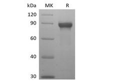 SIGLEC8 Protein - Recombinant Human Siglec-8 (C-mFc)