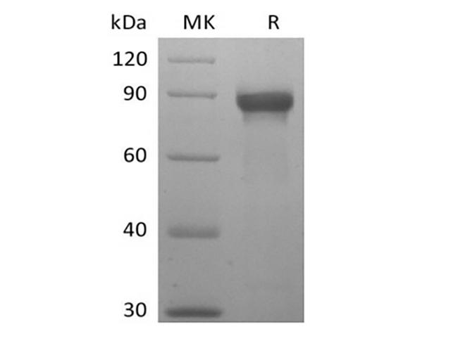 SIGLEC8 Protein - Recombinant Human Siglec-8 (C-mFc)