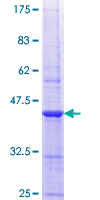 SIK1 / MSK Protein - 12.5% SDS-PAGE Stained with Coomassie Blue.