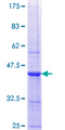 SIK1 / MSK Protein - 12.5% SDS-PAGE Stained with Coomassie Blue.