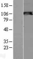SIK2 / SNF1LK2 Protein - Western validation with an anti-DDK antibody * L: Control HEK293 lysate R: Over-expression lysate