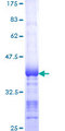 SIK2 / SNF1LK2 Protein - 12.5% SDS-PAGE Stained with Coomassie Blue.