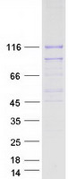 SIK2 / SNF1LK2 Protein - Purified recombinant protein SIK2 was analyzed by SDS-PAGE gel and Coomassie Blue Staining