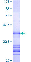 SIK3 / QSK Protein - 12.5% SDS-PAGE Stained with Coomassie Blue.