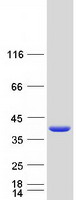SIKE1 Protein - Purified recombinant protein SIKE1 was analyzed by SDS-PAGE gel and Coomassie Blue Staining