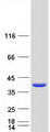 SIKE1 Protein - Purified recombinant protein SIKE1 was analyzed by SDS-PAGE gel and Coomassie Blue Staining