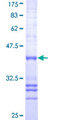 SIM1 Protein - 12.5% SDS-PAGE Stained with Coomassie Blue.