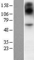 SIM2 Protein - Western validation with an anti-DDK antibody * L: Control HEK293 lysate R: Over-expression lysate