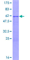 SIMPL / IRAK1BP1 Protein - 12.5% SDS-PAGE of human IRAK1BP1 stained with Coomassie Blue