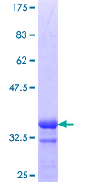SIN3A Protein - 12.5% SDS-PAGE Stained with Coomassie Blue.