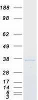 SIP1 Protein - Purified recombinant protein GEMIN2 was analyzed by SDS-PAGE gel and Coomassie Blue Staining