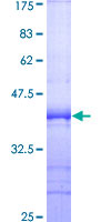 SIPA1 Protein - 12.5% SDS-PAGE Stained with Coomassie Blue.