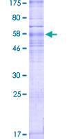 SIPR3 / EDG3 / S1P3 Protein - 12.5% SDS-PAGE of human S1PR3 stained with Coomassie Blue