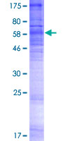SIPR3 / EDG3 / S1P3 Protein - 12.5% SDS-PAGE of human EDG3 stained with Coomassie Blue