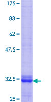 SIPR3 / EDG3 / S1P3 Protein - 12.5% SDS-PAGE Stained with Coomassie Blue.