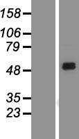 SIRPA / CD172a Protein - Western validation with an anti-DDK antibody * L: Control HEK293 lysate R: Over-expression lysate