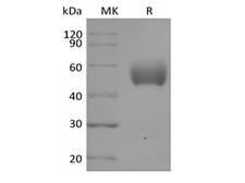 SIRPA / CD172a Protein - Recombinant Human Signal-Regulatory Protein alpha-1/SIRPA/CD172a (C-6His)