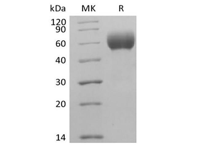 SIRPA / CD172a Protein - Recombinant Human Signal-Regulatory Protein alpha-1/SIRPA/CD172a (C-6His-Avi) Biotinylated
