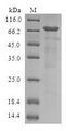SIRPB1 / CD172b Protein - (Tris-Glycine gel) Discontinuous SDS-PAGE (reduced) with 5% enrichment gel and 15% separation gel.
