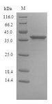 SIRPB1 / CD172b Protein - (Tris-Glycine gel) Discontinuous SDS-PAGE (reduced) with 5% enrichment gel and 15% separation gel.