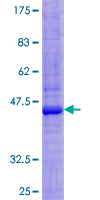 SIRPB1 / CD172b Protein - 12.5% SDS-PAGE of human SIRPB1 stained with Coomassie Blue