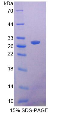 SIRPB1 / CD172b Protein