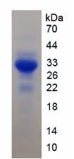 SIRPB1 / CD172b Protein - Recombinant Signal Regulatory Protein Beta 1 By SDS-PAGE
