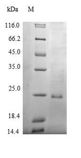 SIRPG Protein - (Tris-Glycine gel) Discontinuous SDS-PAGE (reduced) with 5% enrichment gel and 15% separation gel.