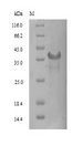 SIRPG Protein - (Tris-Glycine gel) Discontinuous SDS-PAGE (reduced) with 5% enrichment gel and 15% separation gel.