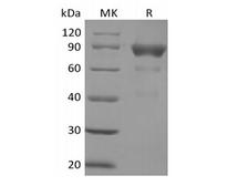 SIRPG Protein - Recombinant Human SIRPB2 (C-Fc)