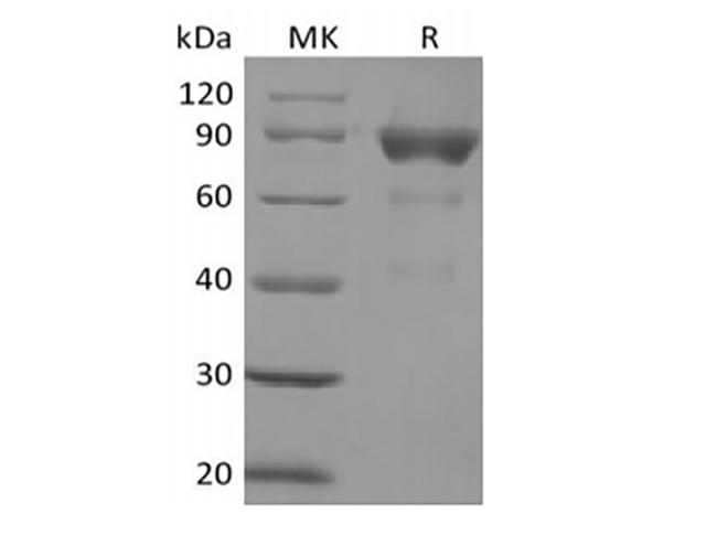 SIRPG Protein - Recombinant Human SIRPB2 (C-Fc)