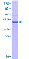 SIRT1 / Sirtuin 1 Protein - 12.5% SDS-PAGE Stained with Coomassie Blue.