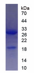 SIRT1 / Sirtuin 1 Protein - Recombinant Sirtuin 1 By SDS-PAGE