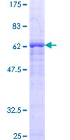 SIRT2 / Sirtuin 2 Protein - 12.5% SDS-PAGE of human SIRT2 stained with Coomassie Blue