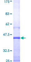 SIRT2 / Sirtuin 2 Protein - 12.5% SDS-PAGE Stained with Coomassie Blue.
