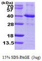 SIRT2 / Sirtuin 2 Protein