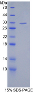 SIRT3 / Sirtuin 3 Protein - Recombinant  Sirtuin 3 By SDS-PAGE