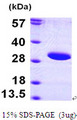 SIRT3 / Sirtuin 3 Protein
