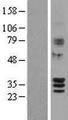 SIRT4 / Sirtuin 4 Protein - Western validation with an anti-DDK antibody * L: Control HEK293 lysate R: Over-expression lysate