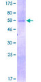 SIRT4 / Sirtuin 4 Protein - 12.5% SDS-PAGE of human SIRT4 stained with Coomassie Blue
