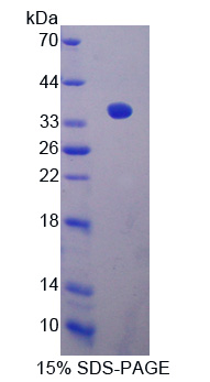 SIRT4 / Sirtuin 4 Protein - Recombinant  Sirtuin 4 By SDS-PAGE