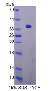 SIRT4 / Sirtuin 4 Protein - Recombinant  Sirtuin 4 By SDS-PAGE