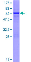 SIRT5 / Sirtuin 5 Protein - 12.5% SDS-PAGE of human SIRT5 stained with Coomassie Blue